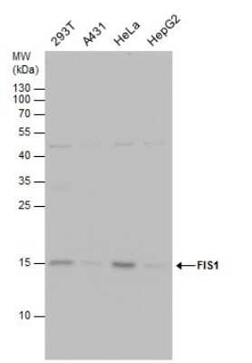 Western Blot: TTC11 Antibody (4211) [NBP2-43771]