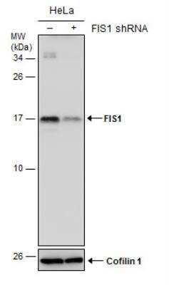 Western Blot: TTC11 Antibody (4211) [NBP2-43771]
