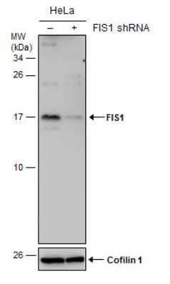 Western Blot: TTC11 Antibody (9810) [NBP2-43628]