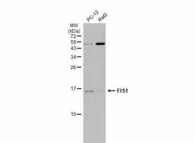 Western Blot: TTC11 Antibody (9810) [NBP2-43628]