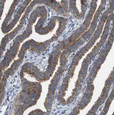Immunohistochemistry-Paraffin: TTC11 Antibody [NBP1-85664]