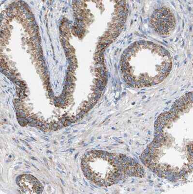 Immunohistochemistry-Paraffin: TTC11 Antibody [NBP1-85664]
