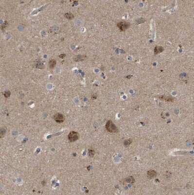 Immunohistochemistry-Paraffin: TTC11 Antibody [NBP1-85664]