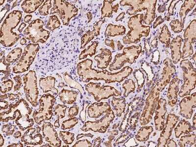 Immunohistochemistry-Paraffin: TTC11 Antibody [NBP2-97168]