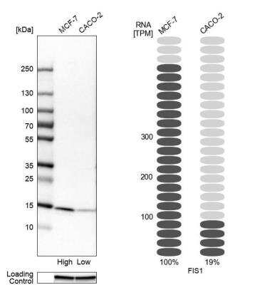 Western Blot: TTC11 Antibody [NBP1-85664]