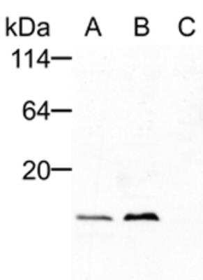 Western Blot: TTC11 Antibody [NBP2-80111]