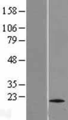 Western Blot: TTC11 Overexpression Lysate [NBL1-10727]