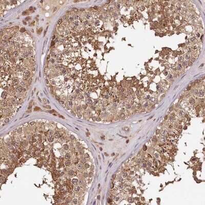 Immunohistochemistry-Paraffin: TTC12 Antibody [NBP1-83693]