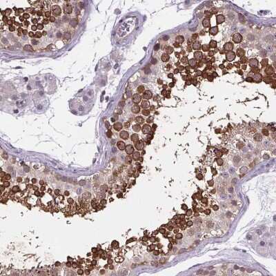 Immunohistochemistry-Paraffin: TTC12 Antibody [NBP2-57113]