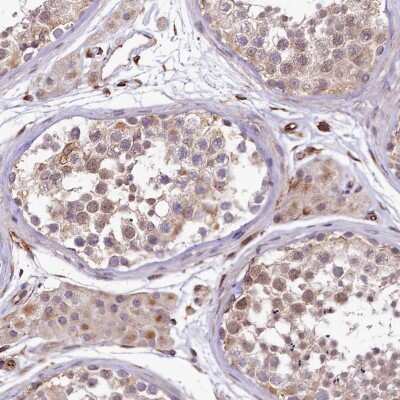 Immunohistochemistry-Paraffin: TTC12 Antibody [NBP2-58627]