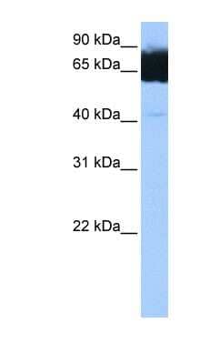 Western Blot: TTC12 Antibody [NBP1-56424]