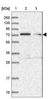 Western Blot: TTC12 Antibody [NBP1-83693]