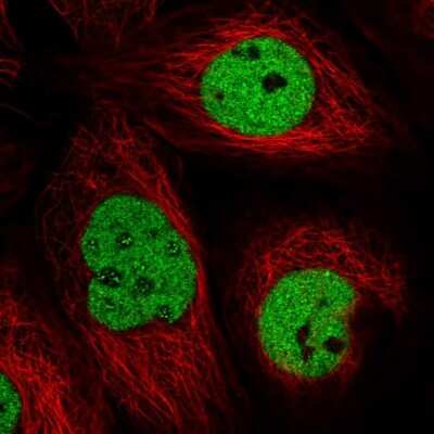 Immunocytochemistry/ Immunofluorescence: TTC13 Antibody [NBP2-58344]