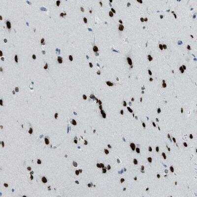 Immunohistochemistry: TTC13 Antibody [NBP1-93942]