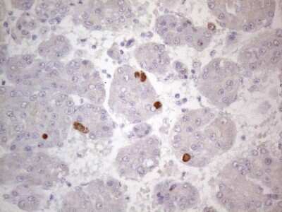 Immunohistochemistry: TTC14 Antibody (OTI9E11) [NBP2-46239]