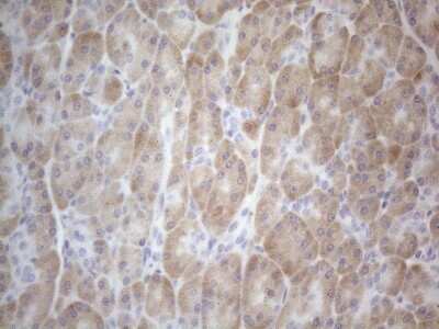 Immunohistochemistry: TTC14 Antibody (OTI9E11) [NBP2-46239]