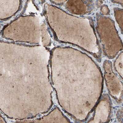 Immunohistochemistry-Paraffin: TTC14 Antibody [NBP1-84657]