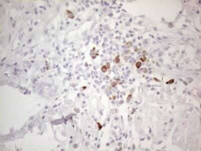 Immunohistochemistry: TTC14 Antibody (OTI9E11) - Azide and BSA Free [NBP2-74655]