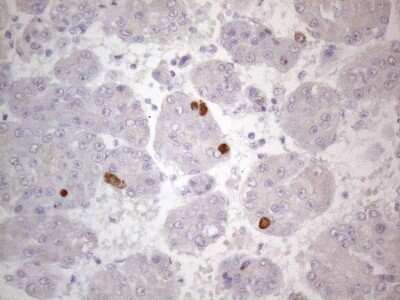 Immunohistochemistry: TTC14 Antibody (OTI9E11) - Azide and BSA Free [NBP2-74655]