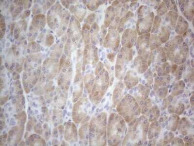 Immunohistochemistry: TTC14 Antibody (OTI9E11) - Azide and BSA Free [NBP2-74655]