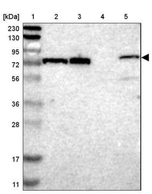 Western Blot: TTC14 Antibody [NBP1-84657]