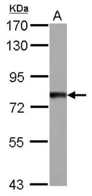 Western Blot: TTC14 Antibody [NBP2-20753]