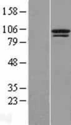 Western Blot: TTC14 Overexpression Lysate [NBL1-17398]