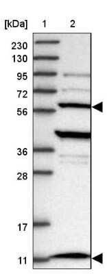 Western Blot: TTC15 Antibody [NBP1-84500]