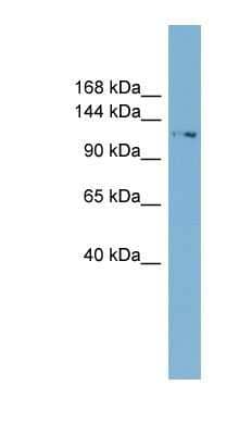 Western Blot: TTC17 Antibody [NBP1-57958]