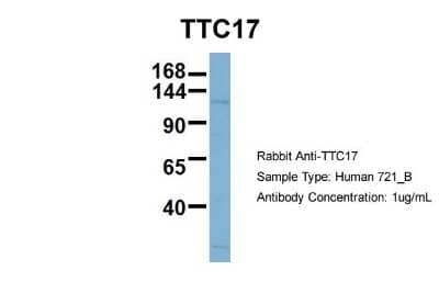 Western Blot: TTC17 Antibody [NBP1-57958]