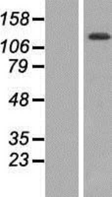 Western Blot: TTC17 Overexpression Lysate [NBP2-06841]