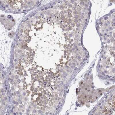 Immunohistochemistry-Paraffin: TTC18 Antibody [NBP2-32689]