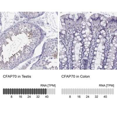 Immunohistochemistry-Paraffin: TTC18 Antibody [NBP2-62668]