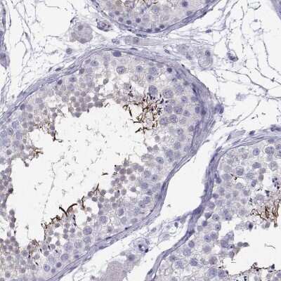 Immunohistochemistry-Paraffin: TTC18 Antibody [NBP2-62668]