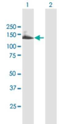 Western Blot: TTC18 Antibody [H00118491-B01P]