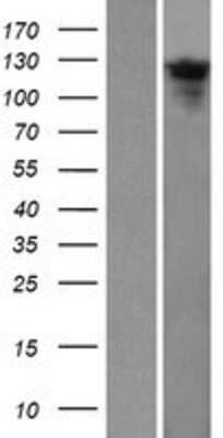 Western Blot: TTC18 Overexpression Lysate [NBP2-05499]