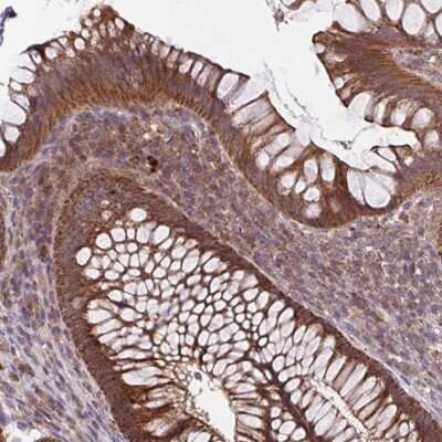 Immunohistochemistry: TTC19 Antibody [NBP2-38667]