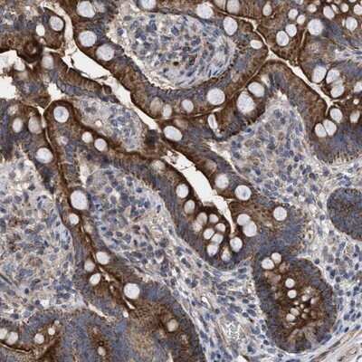 Immunohistochemistry-Paraffin: TTC19 Antibody [NBP1-93979]