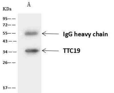 Immunoprecipitation: TTC19 Antibody [NBP2-98556]