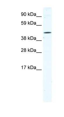 Western Blot: TTC19 Antibody [NBP1-91534]