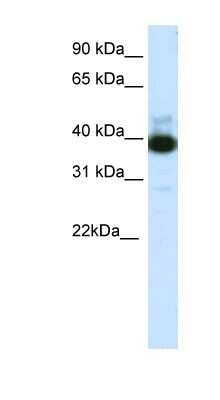 Western Blot: TTC19 Antibody [NBP1-91552]