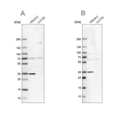 Western Blot: TTC19 Antibody [NBP2-38667]