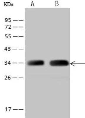 Western Blot: TTC19 Antibody [NBP2-98556]