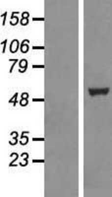 Western Blot: TTC19 Overexpression Lysate [NBP2-06921]