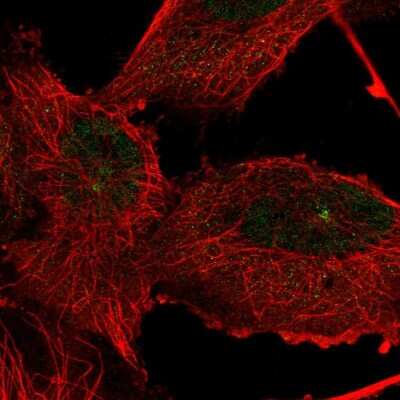 Immunocytochemistry/ Immunofluorescence: TTC21A Antibody [NBP2-34008]