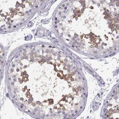 Immunohistochemistry-Paraffin: TTC21A Antibody [NBP2-34008]