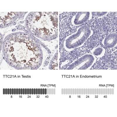 Immunohistochemistry-Paraffin: TTC21A Antibody [NBP2-34008]