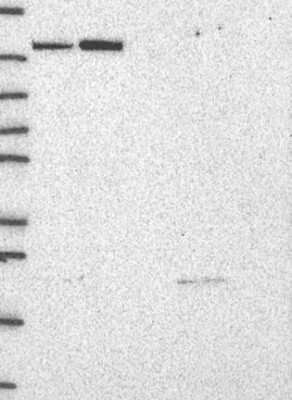 Western Blot: TTC21B Antibody [NBP3-17451]