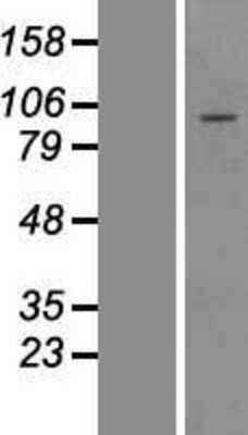 Western Blot: TTC21B Overexpression Lysate [NBP2-06291]