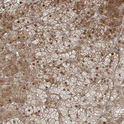 Immunohistochemistry-Paraffin: TTC22 Antibody [NBP1-93970]